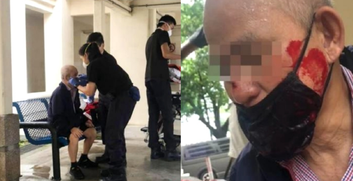 ELDERLY MAN BREAKS NOSE AFTER HIT & RUN BY PMD AS HE FALLS TO GROUND FACE FIRST