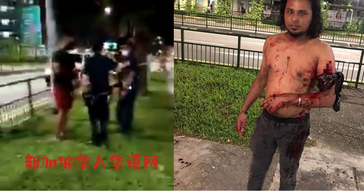 MAN SLASHED TILL SEE BONE AT COFFEESHOP WITHOUT KNOWING WHAT HAPPENED