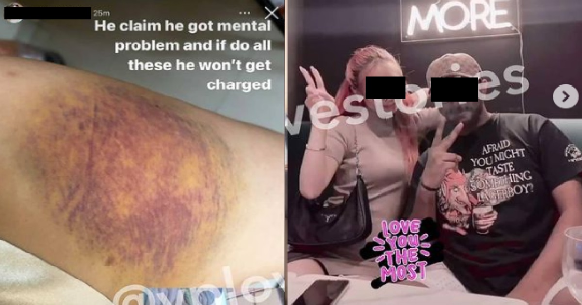 GUY ATTACKS GF, SAY HE GOT MENTAL PROBLEM SO WON’T GET CHARGED