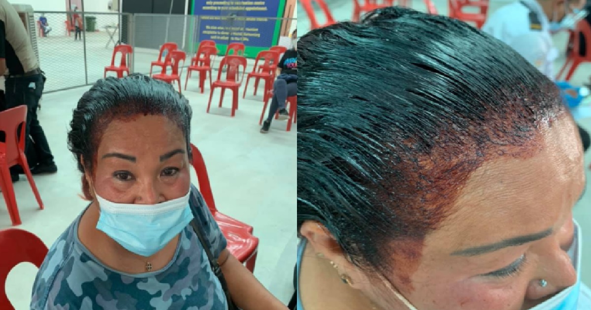 M’SIA AUNTIE DYE HAIR HALFWAY, RUSH DOWN TO GET VACCINATED