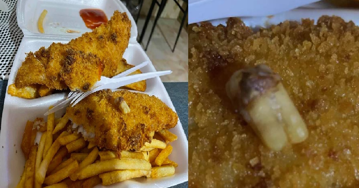 WOMAN FINDS TOOTH INSIDE HER FISH AND CHIPS