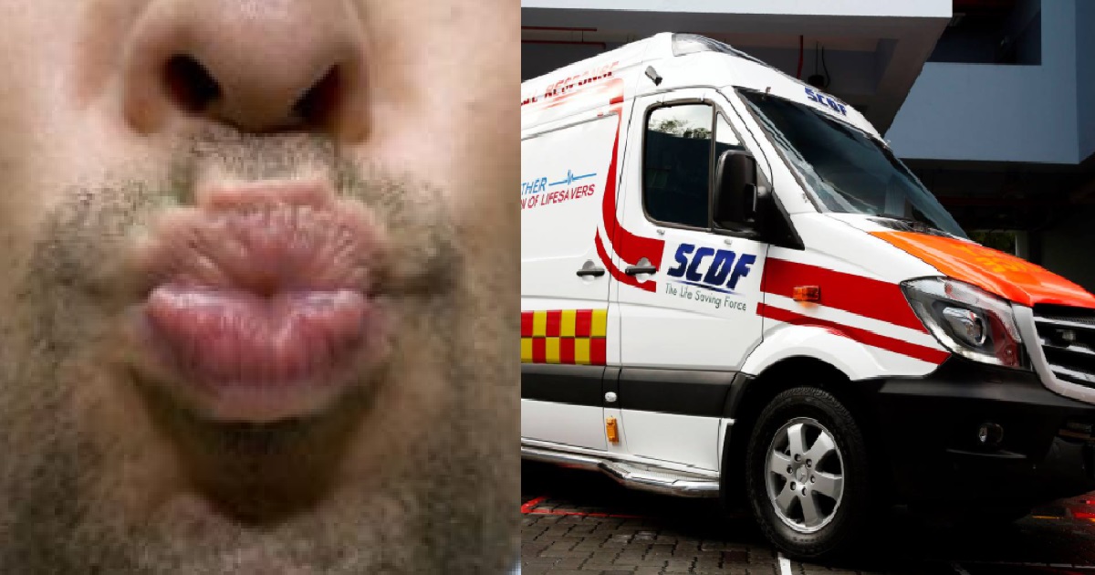 SCDF OFFICER ALLEGEDLY MOLEST COLLEAGUE IN AMBULANCE, KISS HIS MOUTH