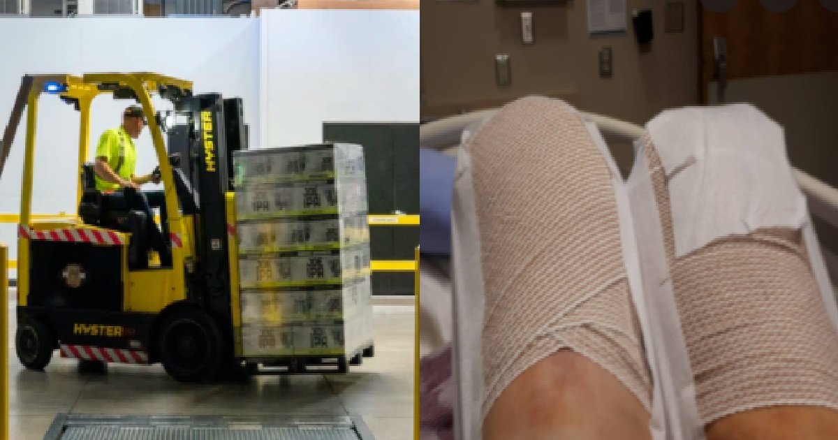 FW RUNS OVER MAN’S LEGS WITH FORKLIFT, VICTIM NEEDED TO AMPUTATE BOTH LEGS