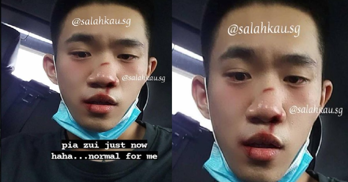 YP FIGHT FINISH, SHOW OFF HIS BRUISES, SAY: “HAHA NORMAL FOR ME”