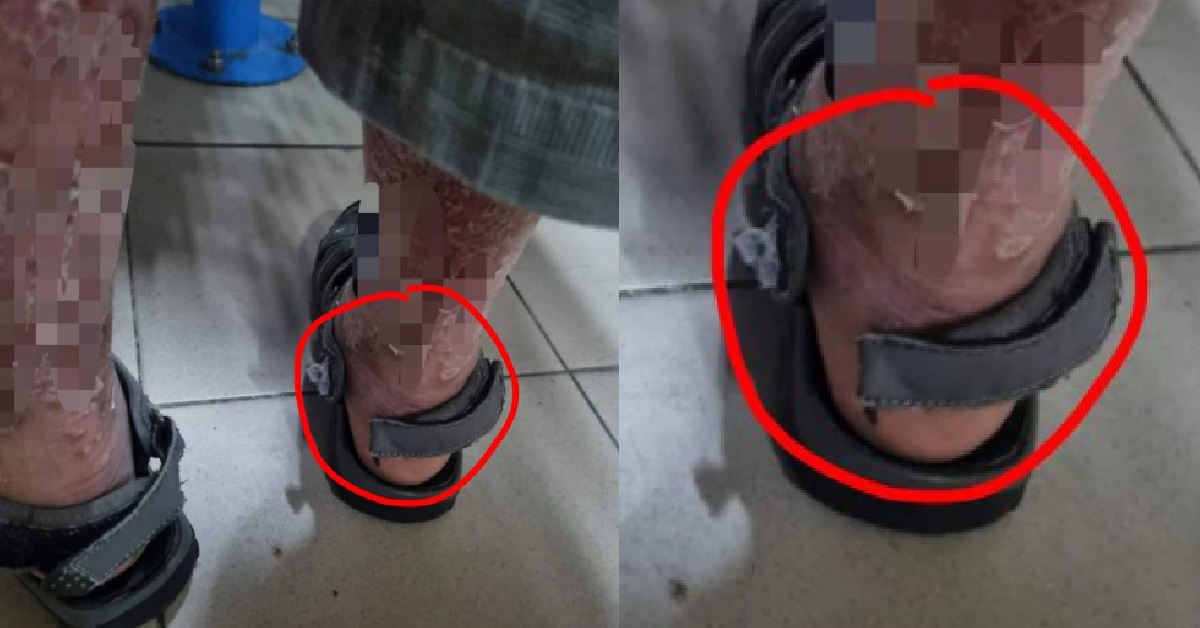 DOWN SYNDROME MAN’S SANDALS STRAP CUT BY HEARTLESS VANDAL