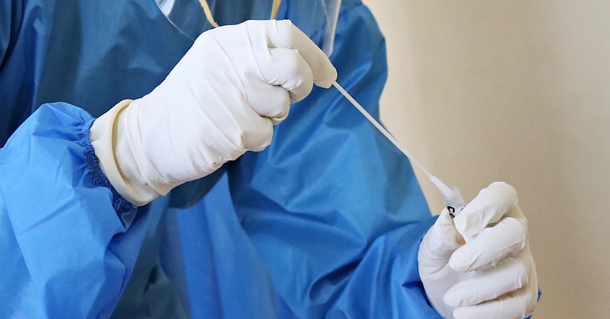 177 COVID-19 CASES REPORTED TODAY, 90 UNLINKED