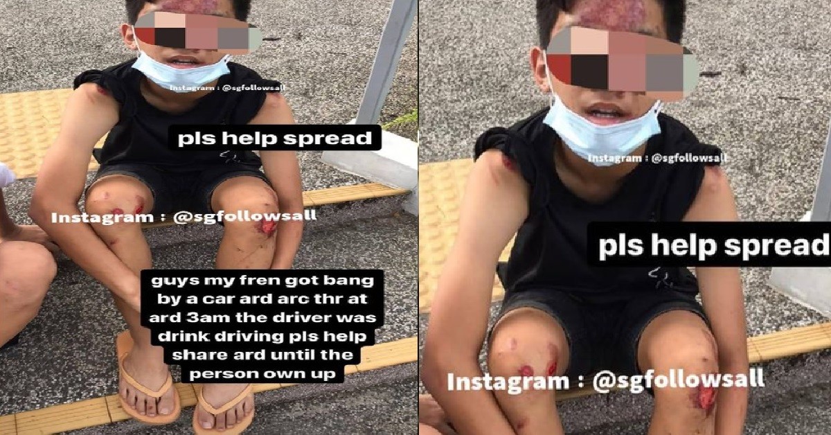 XDD KENA BANG BY DRUNK DRIVER, NETIZEN APPEALING FOR WITNESSES