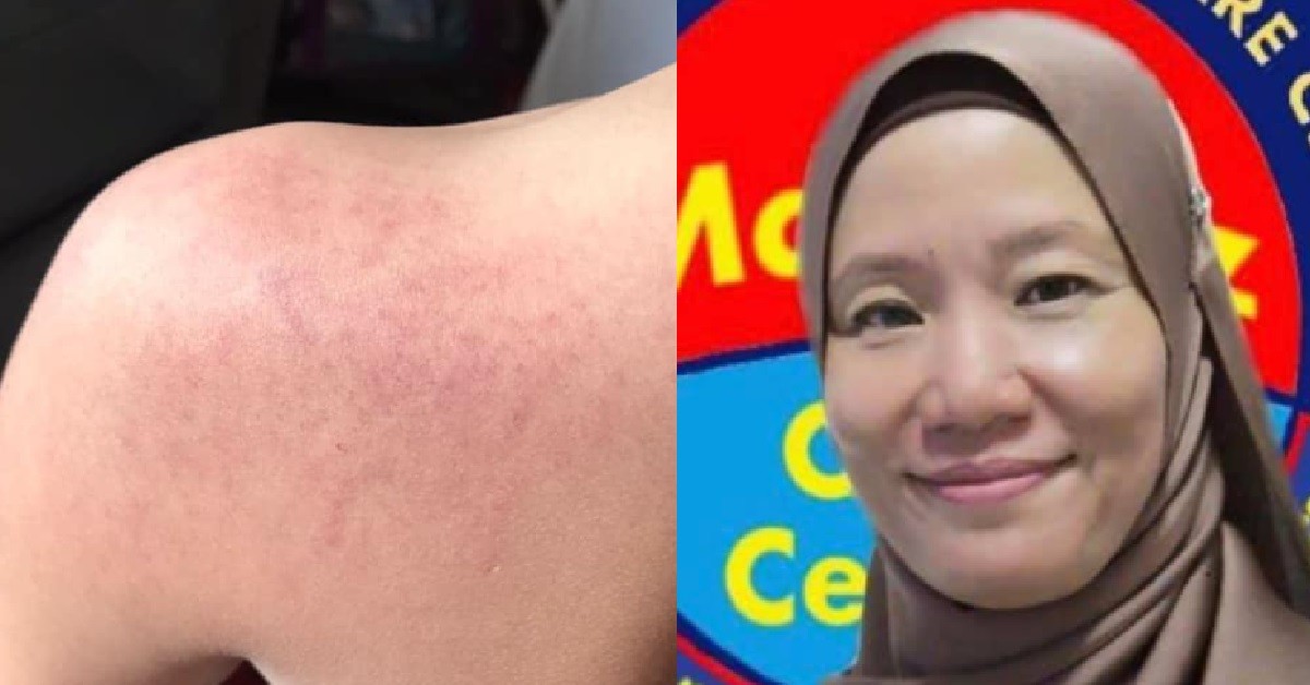 S’PORE WOMAN ALLEGEDLY HANTAM AUTISTIC BOY IN M’SIA, CHARGED