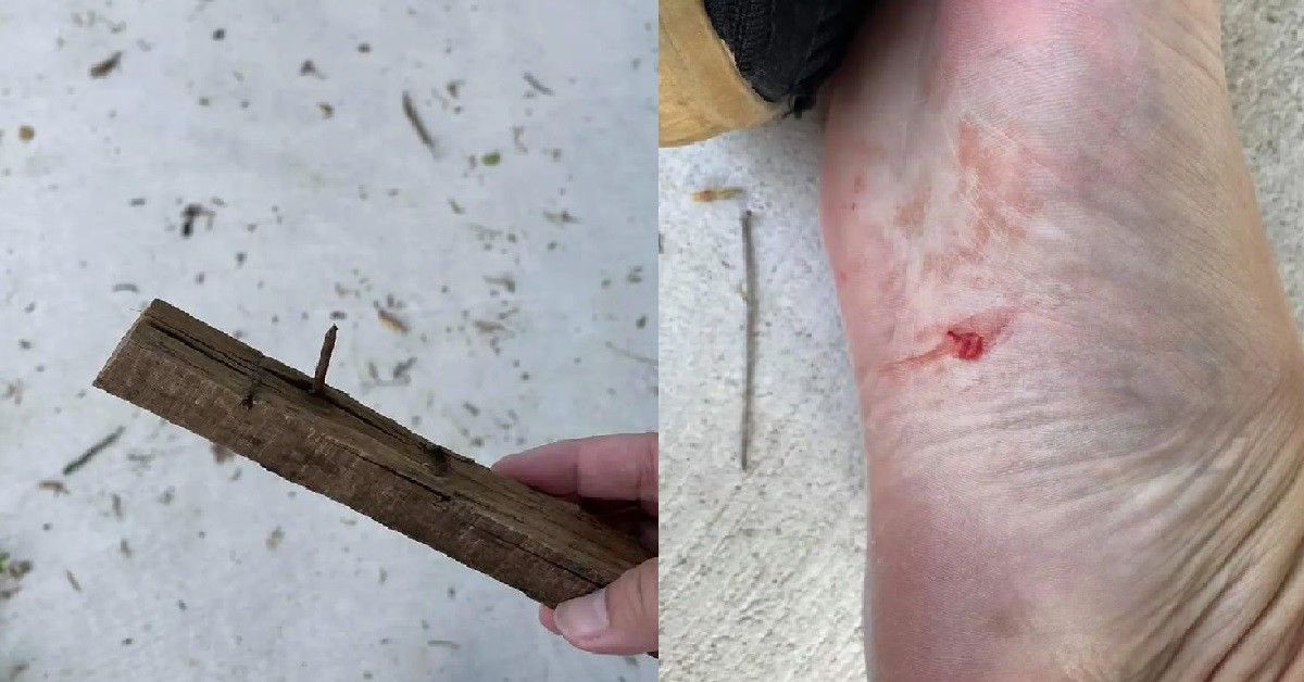 MAN STEPPED ON RUSTY IRON NAIL LEFT BEHIND BY CONSTRUCTION SITE