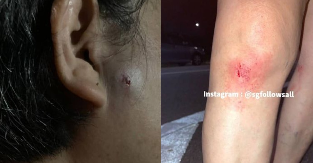 JOGGER RAN INTO WOMAN CYCLING, CAUSING THE BICYCLE TO CRASH