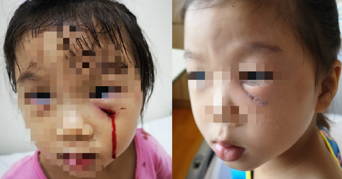 3 Y.O GIRL ATTACKED BY RESIDENT’S PET PEACOCK, OWNERS BLAME GIRL INSTEAD