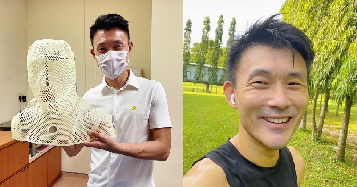 TAMPINES GRC MP BAEY YAM KENG DIAGNOSED WITH NOSE CANCER,