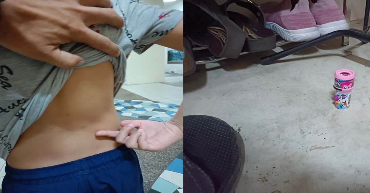MAN CLAIMS SON’S FRIEND THREW FLASHLIGHT AT HIS SON INJURING HIS LOWER BACK