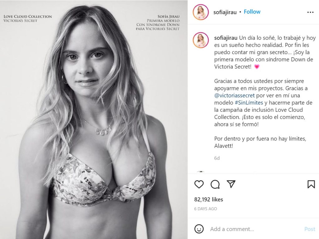 VICTORIA'S SECRET INTRODUCES DOWN SYNDROME MODEL