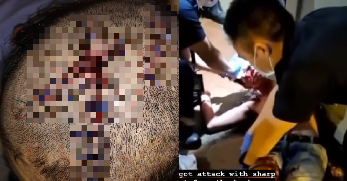 SECOND SUSPECT WHO SMASHED GLASS BOTTLE ON STRANGER’S HEAD, GETS JAIL & CANING