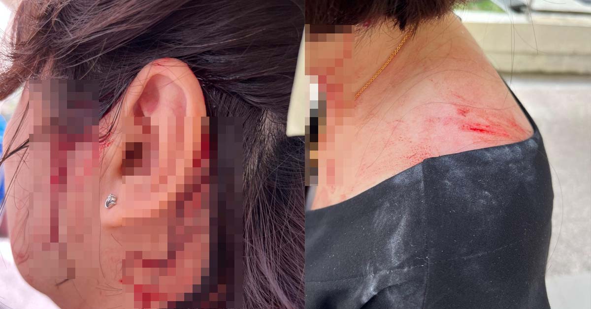 CEILING TILES FALLS FROM YISHUN WALKWAY & INJURING MOTHER