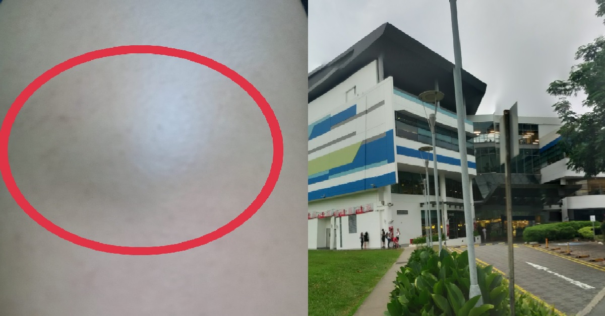 WOMAN ALLEGEDLY ASSAULTED BY CRAZY AUNTIE USING AN UMBRELLA