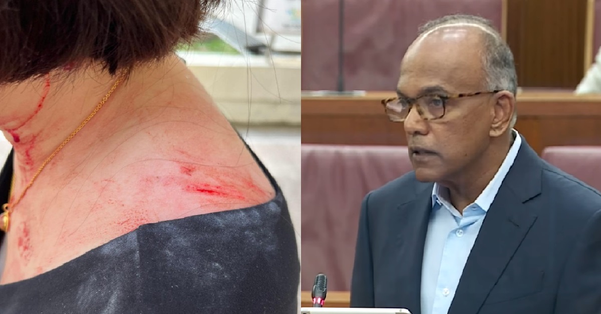 K SHANMUGAM MET WITH WOMAN INJURED IN YISHUN WALKWAY ACCIDENT