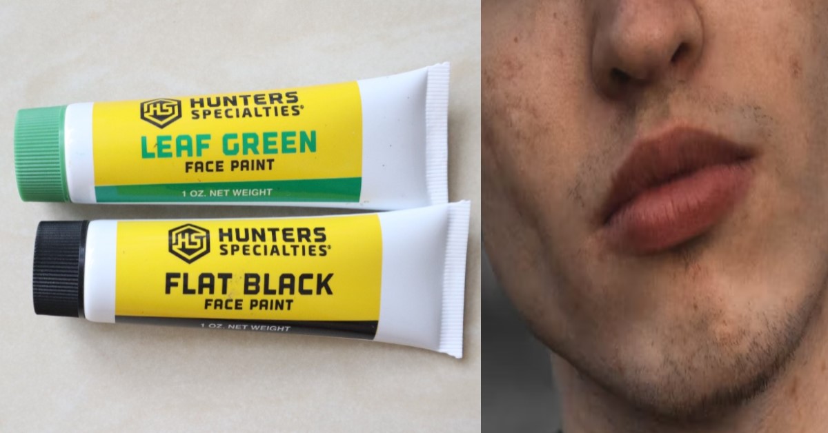GUY SAYS FACIAL COMPLEXION SCREWED UP AFTER ENLISTMENT