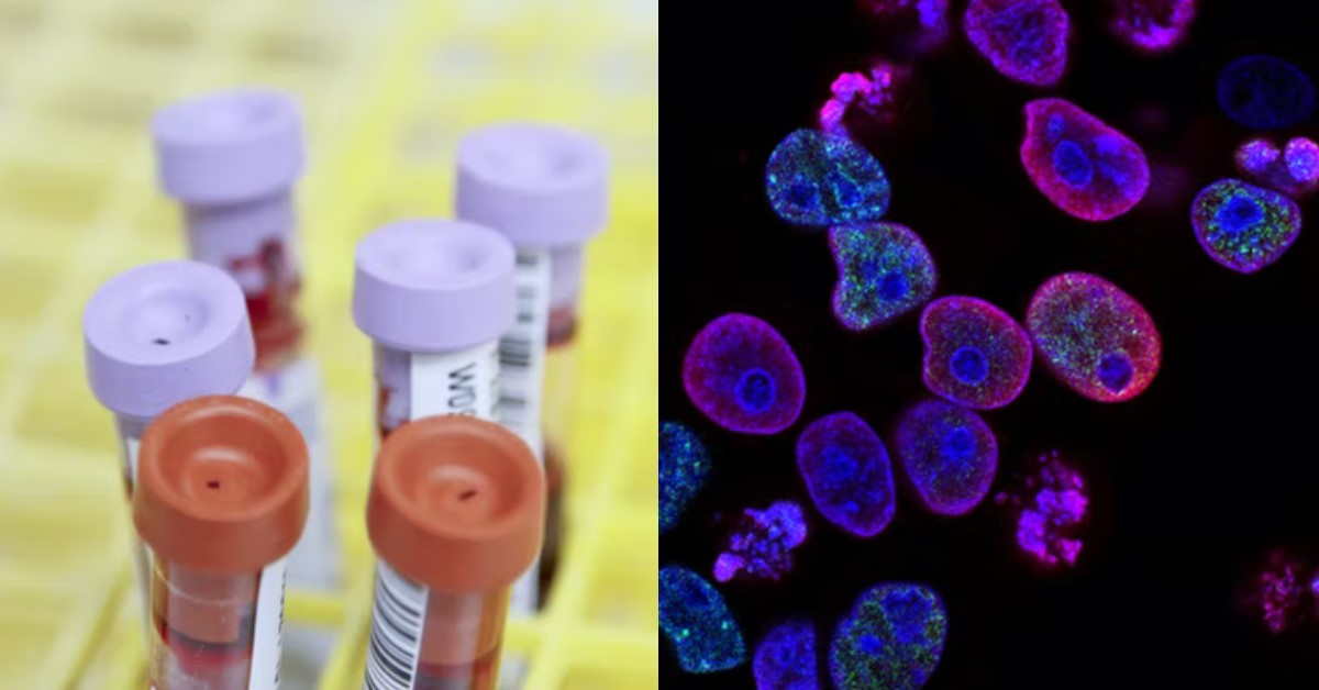 GIRL TAKES DNA TEST, FINDS OUT SHE IS NOT RELATED TO HER RELATIVES