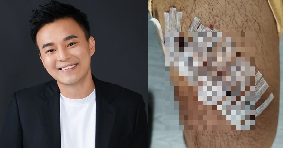 FORMER ACTOR JOSHUA ANG THROWN 6-7 METRES IN MOTORCYCLE ACCIDENT