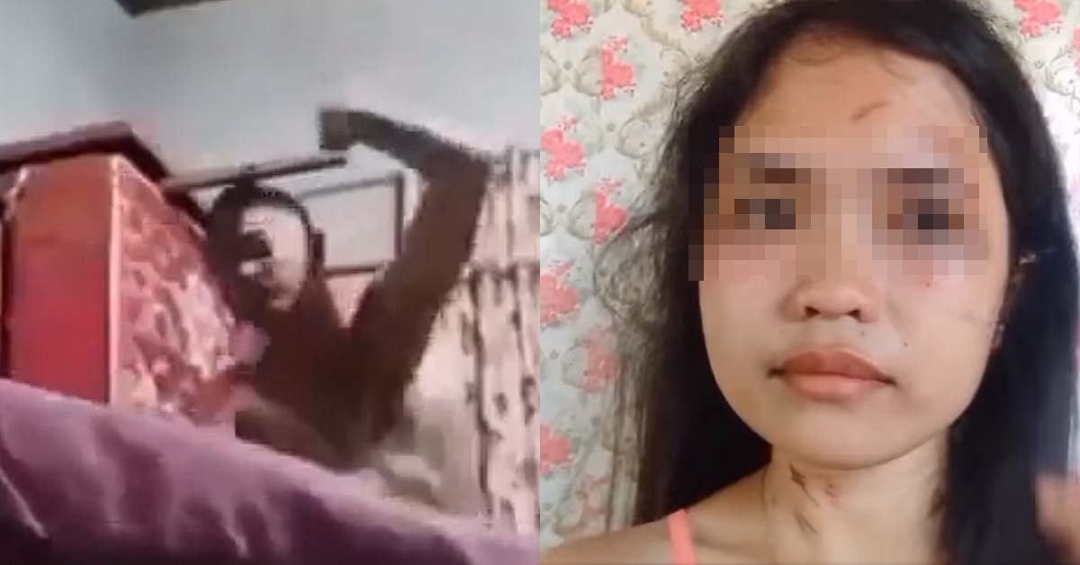 WOMAN GETS BEAT UP BY BF, POSTED HER INJURIES & ADVISES OTHERS