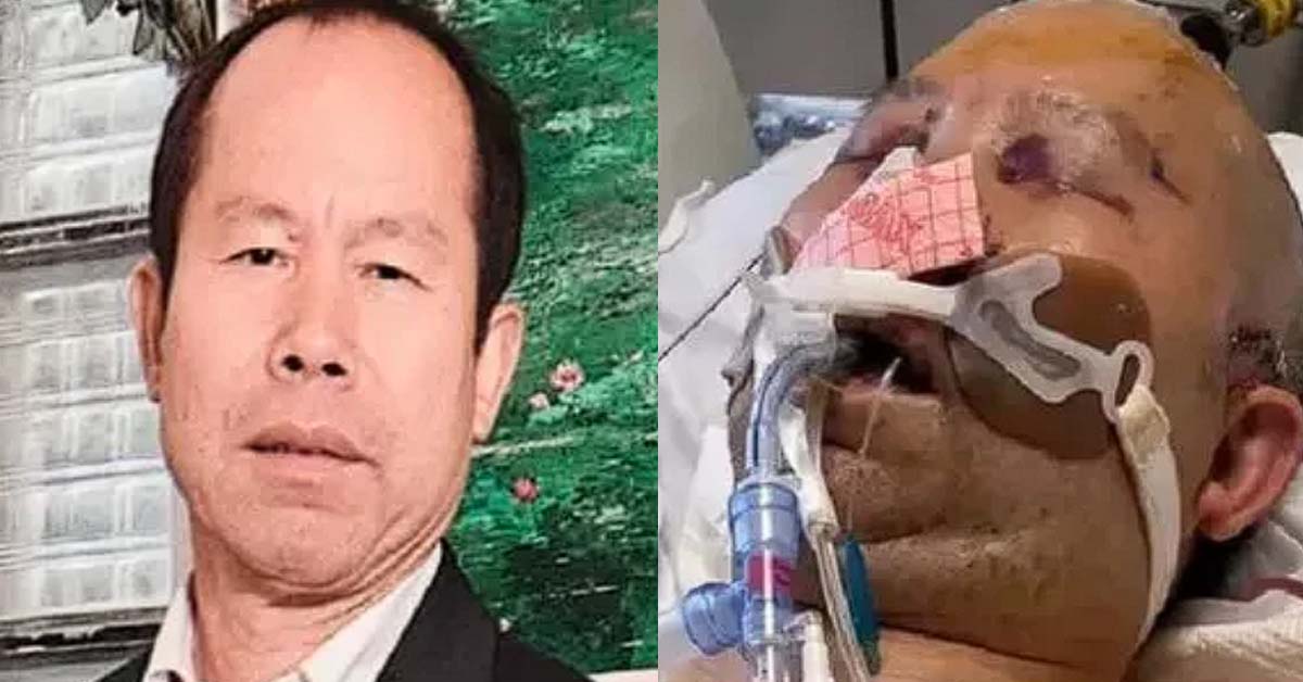 ASIAN MAN BEATEN UP IN CHICAGO, MIGHT FACE PERMANENT BRAIN DAMAGE