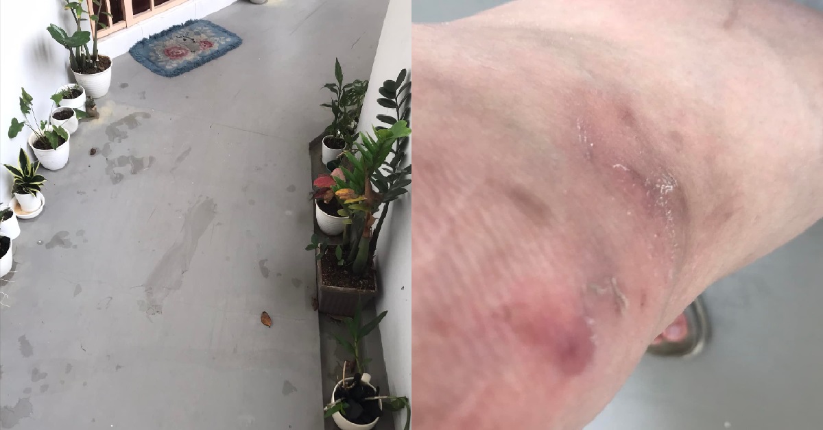 MAN FALLS DOWN ON SLIPPERY FALL @ HDB WALKWAY, BLAMES NEIGHBOUR’S PLANTS