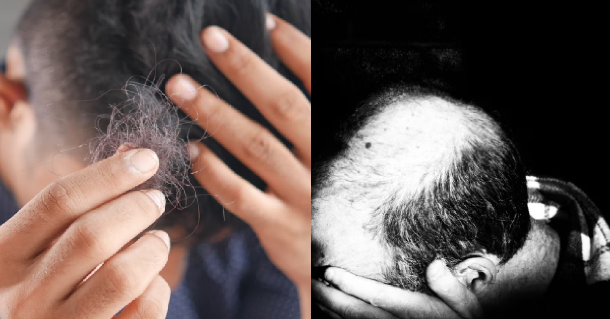MAN STARTED BALDING AT 23, CAN’T GET GIRLS SO HE TURNED TO ESCORTS