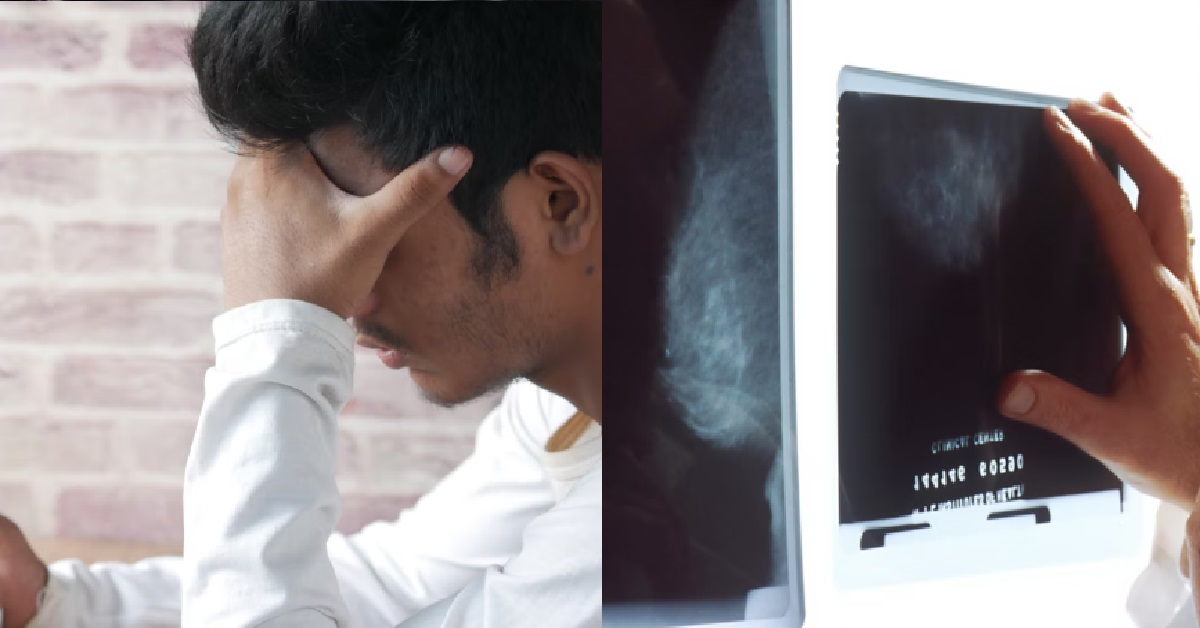 GUY GOING CRAZY AFTER HAVING HEADACHE FOR 83 DAYS, MRI SCAN SHOWS NOTHING