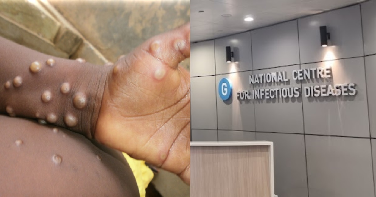 MOH – S’PORE CONFIRMS FIRST LOCAL CASE OF MONKEYPOX ON 6 JULY