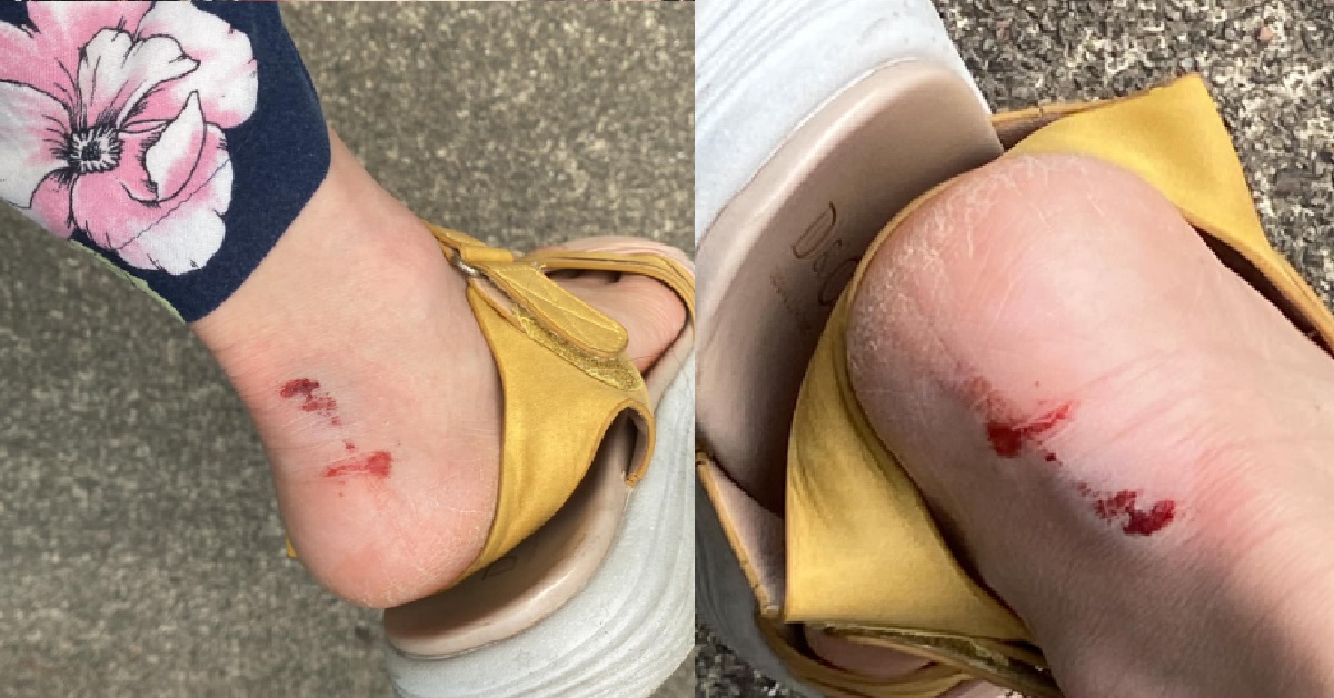 MAN BROUGHT FOLDABLE BIKE INTO CROWDED MRT, HITS WOMAN INSIDE THE TRAIN