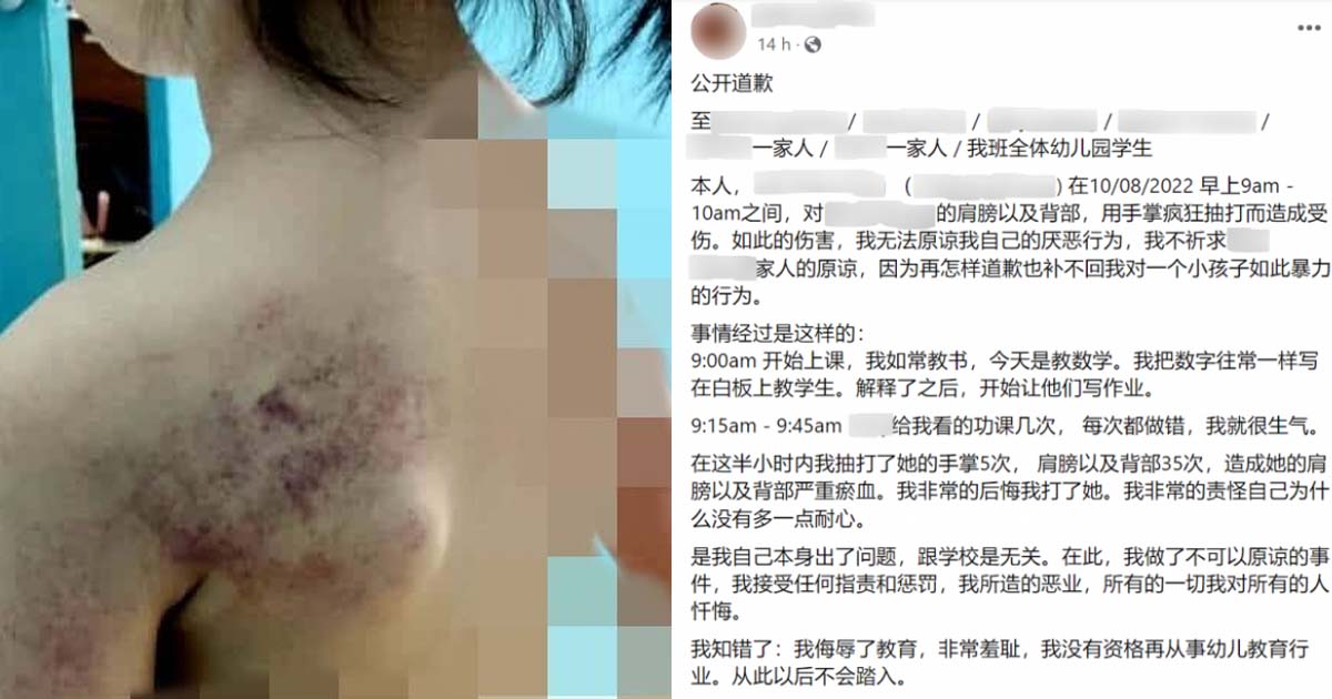 M’SIAN TEACHER BEATS UP KINDERGARTEN GIRL AND APOLOGIZED ON FACEBOOK