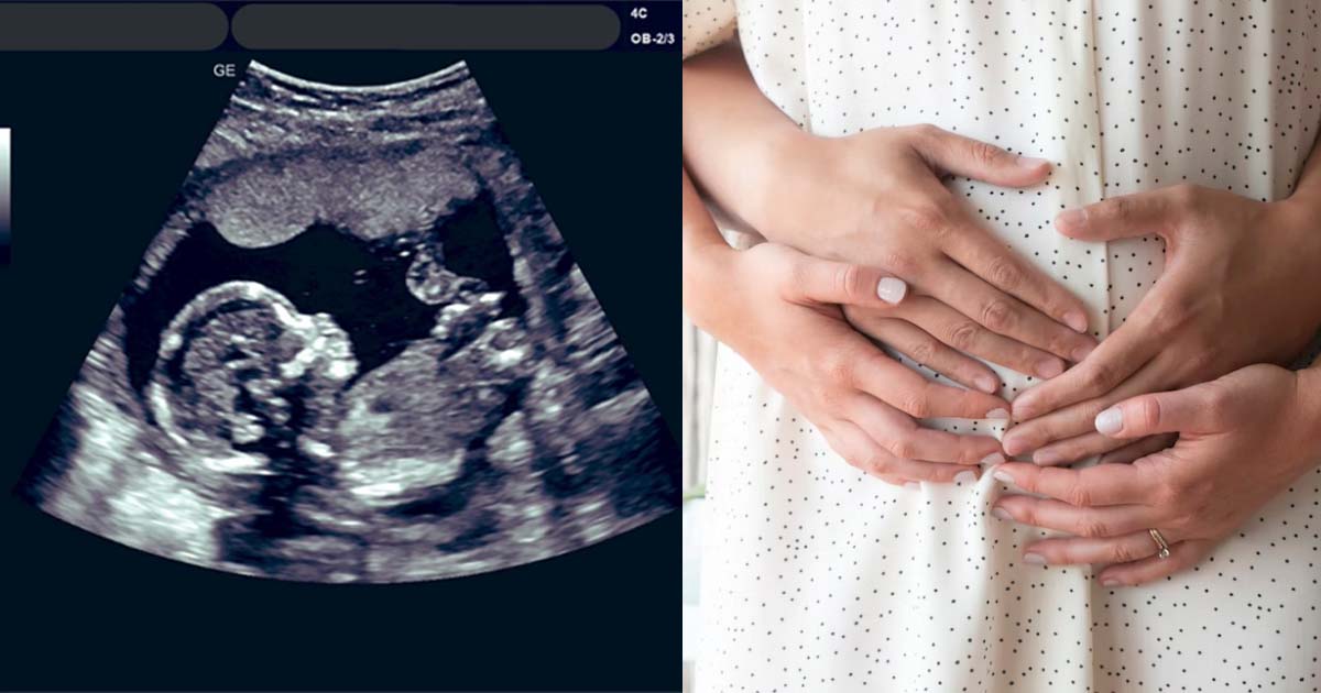 WIFE ADMITS TO GETTING PREGNANT ON PURPOSE TO TRAP HUSBAND SO HE CAN’T LEAVE