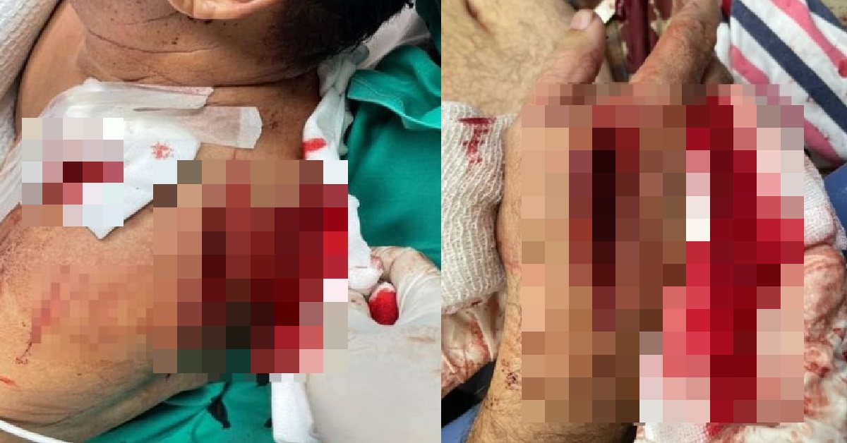 MAN SLASHED BY BURGLARS WITH PARANG, AFTER THEY BROKE INTO HIS HOME & ROBBED HIM