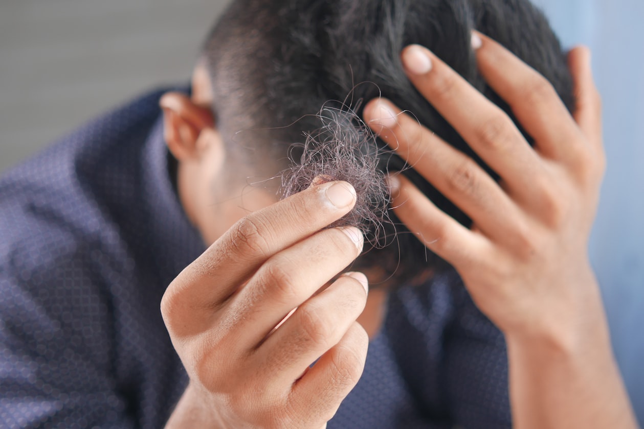 MAN RESIGNS $10K/MONTH JOB TO DO WHAT HE LOVES, LOSES ALL HIS HAIR & GETS SICK