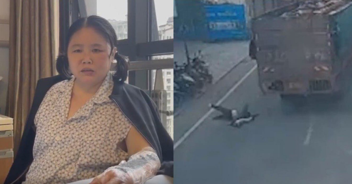 PRC WOMAN SAVE 2 Y.O BOY FROM A TRUCK BUT LOST HER LEFT ARM PERMANENTLY