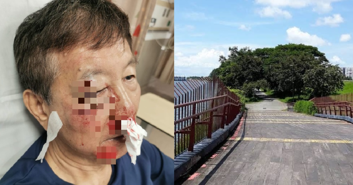 CYCLIST ATTACKED BY WILD BOAR @ PUNGGOL, SUFFERS MULTIPLE FRACTURES