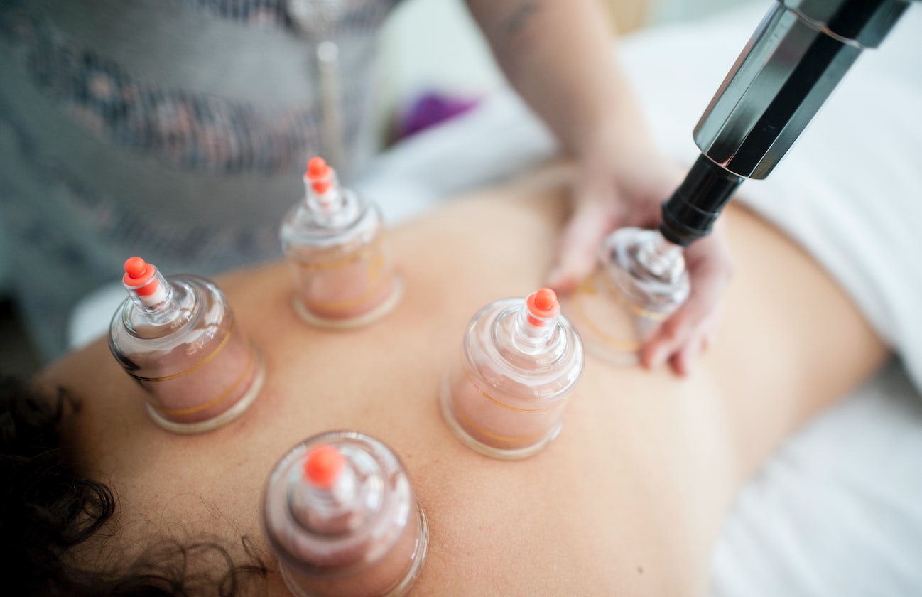 MAN ADDICTED TO ‘CUPPING’, SAYS NO CUPPING WHOLE BODY UNCOMFORTABLE