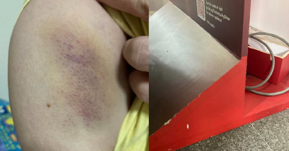 WOMAN TRIPPED OVER SIGN PLACED NEXT TO NTUC EXIT, MANAGER ALLEGEDLY DIDN’T APOLOGISE