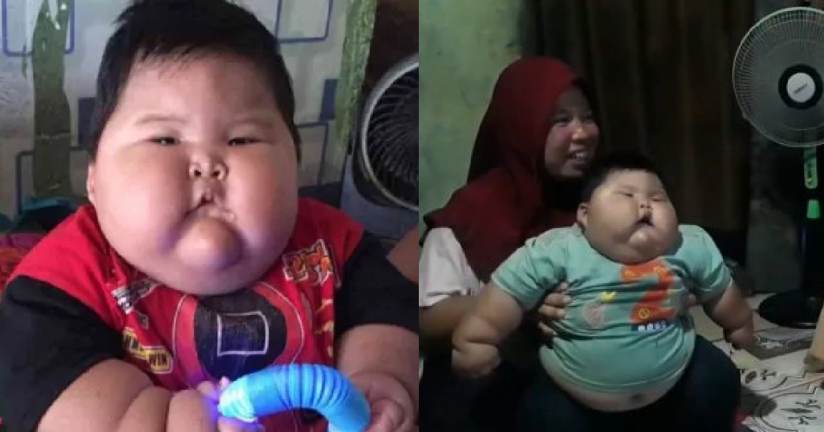 16-MONTH-OLD BABY WEIGHS 27KG, FITS INTO DAD’S CLOTHES & WEARS XXXL DIAPERS