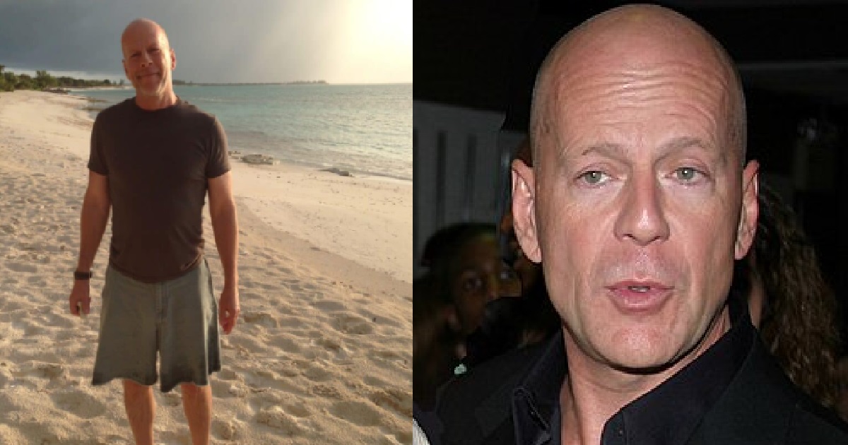 ACTOR BRUCE WILLIS DIAGNOSED WITH DEMENTIA, NO CURE OR TREATMENT FOR IT
