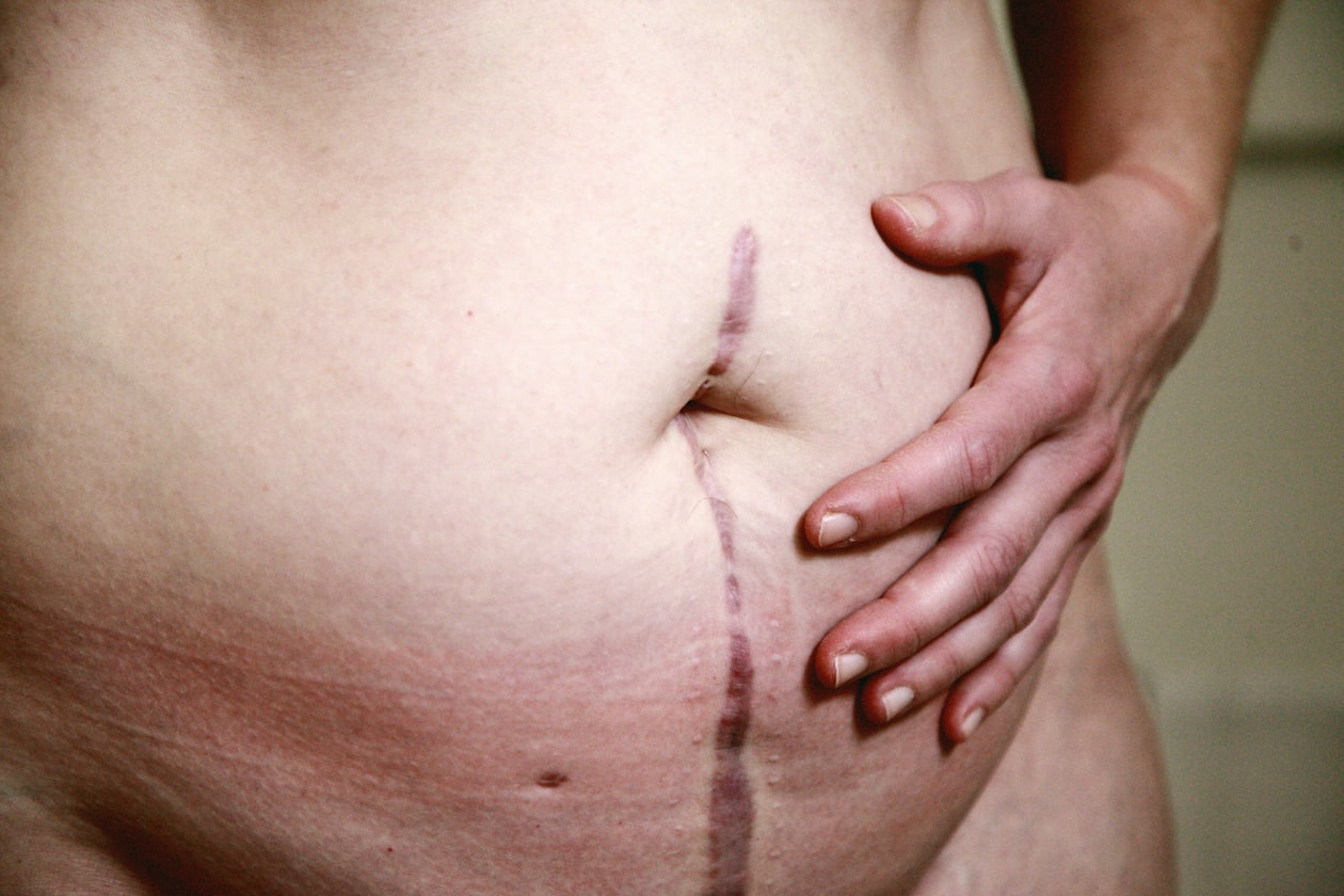MAN DRINKS BEER UNTIL HIS TUMMY COVERS HIS ‘KKJ’