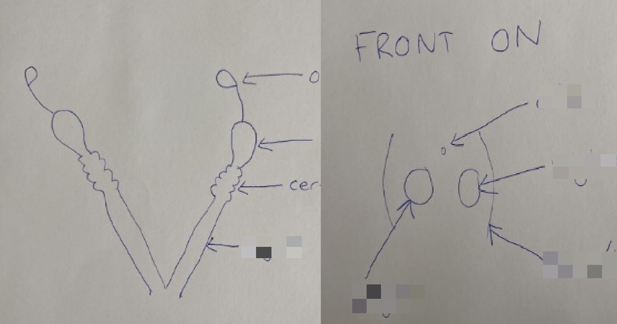 WOMAN BORN WITH 2 CBs, USES ONE FOR ESCORT WORK & THE OTHER ONE FOR HER BF