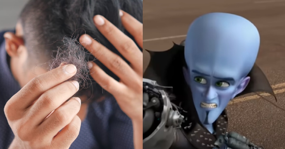 30 Y.O MAN “JUST REALISED” THAT HE’S UGLY, SAYS HE’S BALDING & LOOKS LIKE MEGAMIND