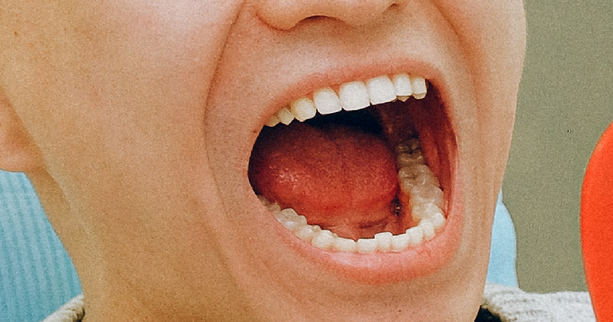 BF’S MOUTH SMELLS LIKE RUBBISH BIN, REFUSE TO BRUSH TEETH & STILL WANT TO KISS
