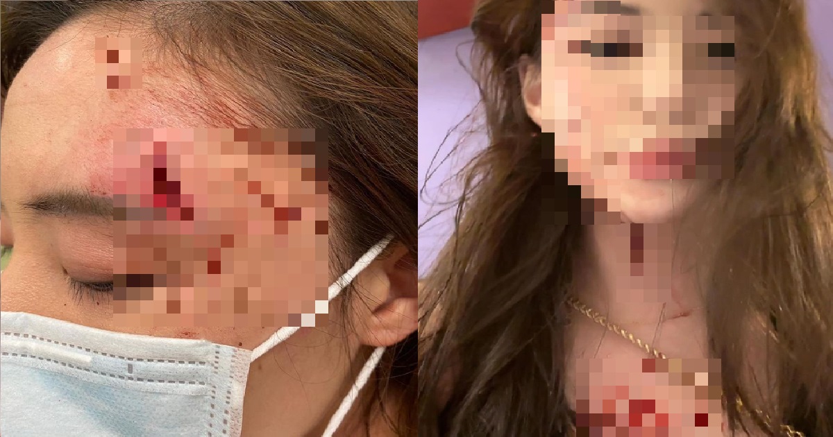 WOMAN WHO WAS ATTACKED BY MAN @ CLARKE QUAY, SAYS HE WENT BACK TO PARTY AFTER BEING BAILED