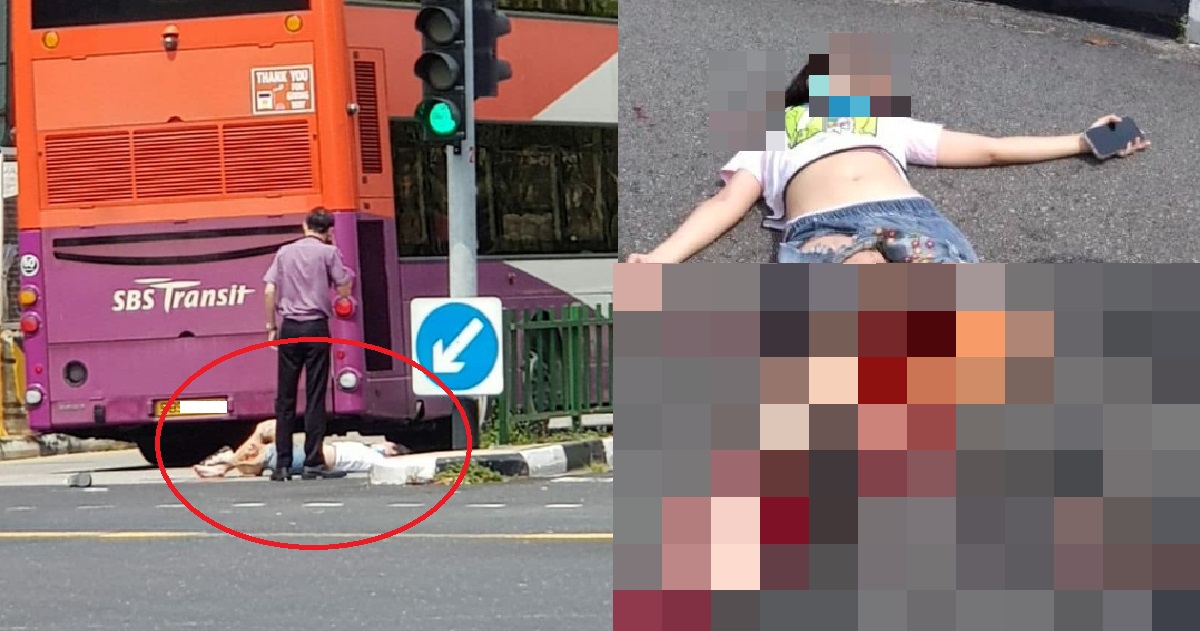 61 Y.O BUS DRIVER PLEADS “NOT GUILTY” TO ACCIDENT THAT TORE SKIN OFF WOMAN’S LEG