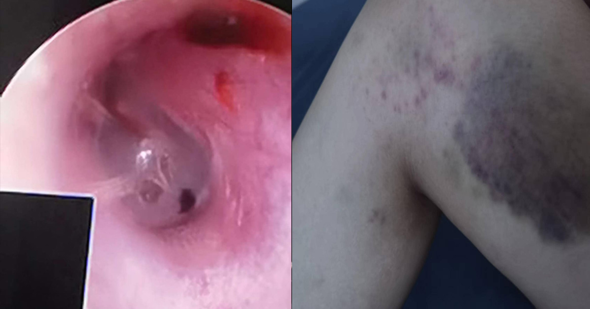 M’SIAN BF BEATS UP GF, CALLS HER A KAMPONG WOMAN FROM PERAK