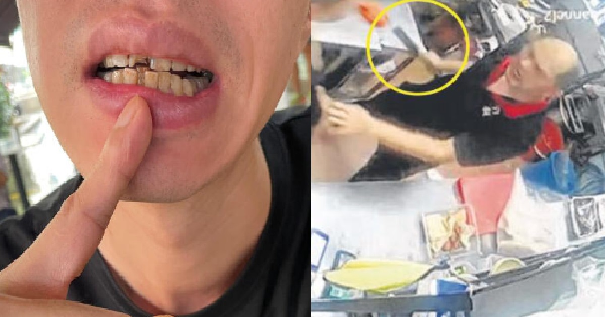 F&B STAFF UPSET MANAGER NAGGED HIM FOR “MESSY KITCHEN”, PUNCHED & KNOCKED OUT HIS TOOTH